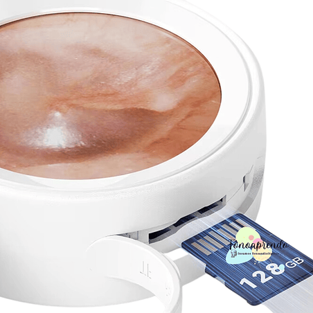 Otoscopio con Pantalla LCD 6