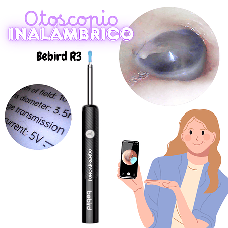 Otoscopio inalámbrico Bebird - R3. Nuevo modelo ! 3