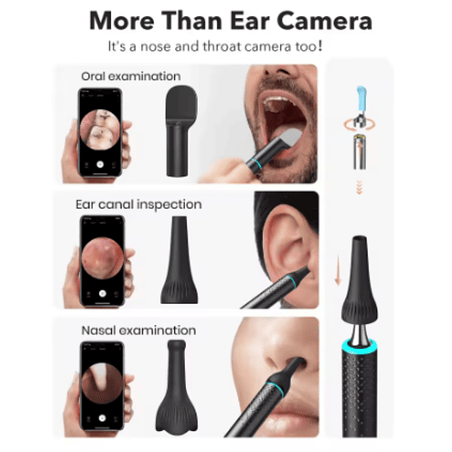 Otoscopio inalámbrico Bebird - R3. Nuevo modelo ! 5