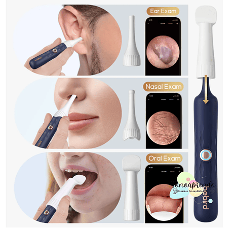 Otoscopio digital - Bebird Earsight Plus I35R. 6