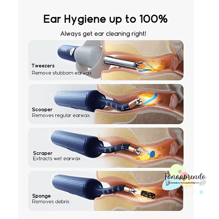 Otoscopio digital - Bebird Earsight Plus I35R. 9