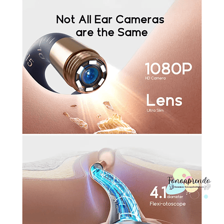 Otoscopio digital - Bebird Earsight Plus I35R. 10