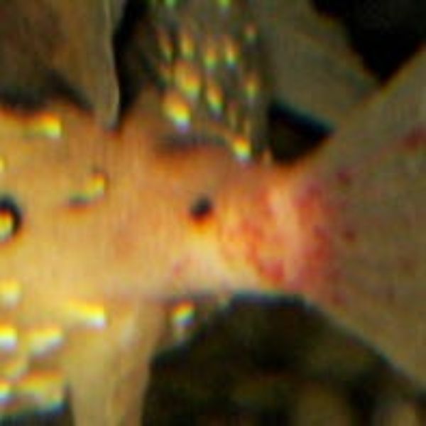 Vibriosis 2