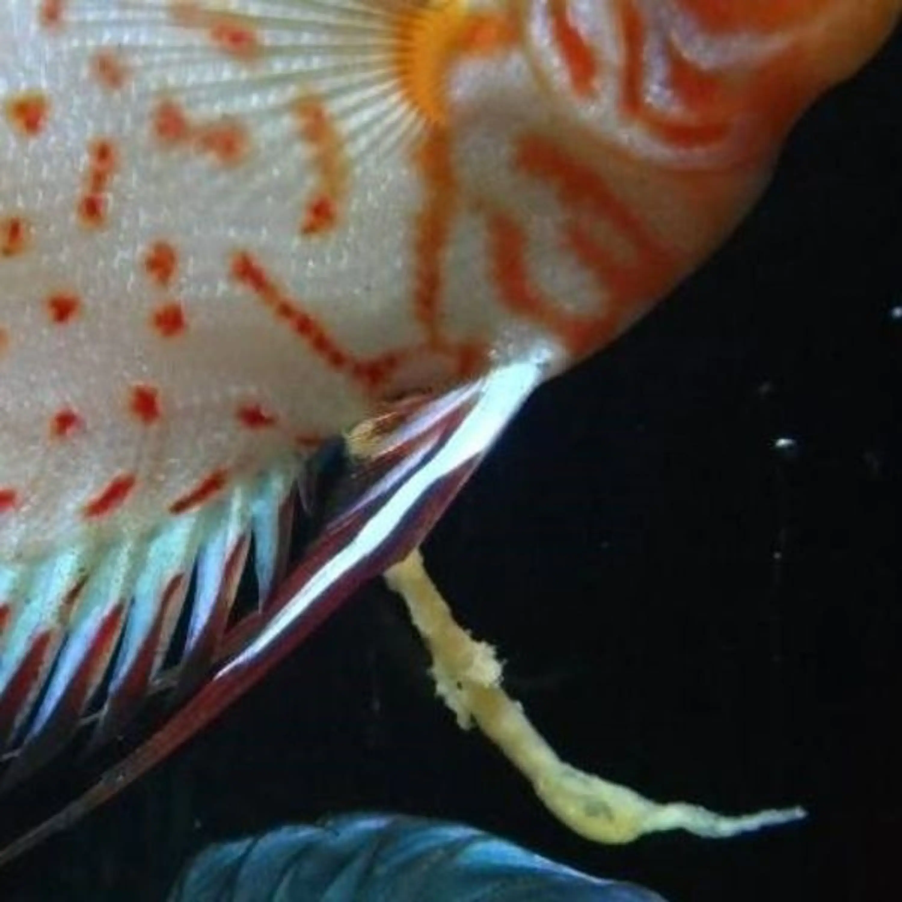 Doenças intestinais