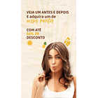 Pack Canva Bronzeamento Templates Editável 29 Artes Storie + Bônus 4