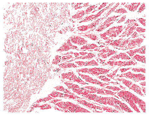 Esophagus Muscularis