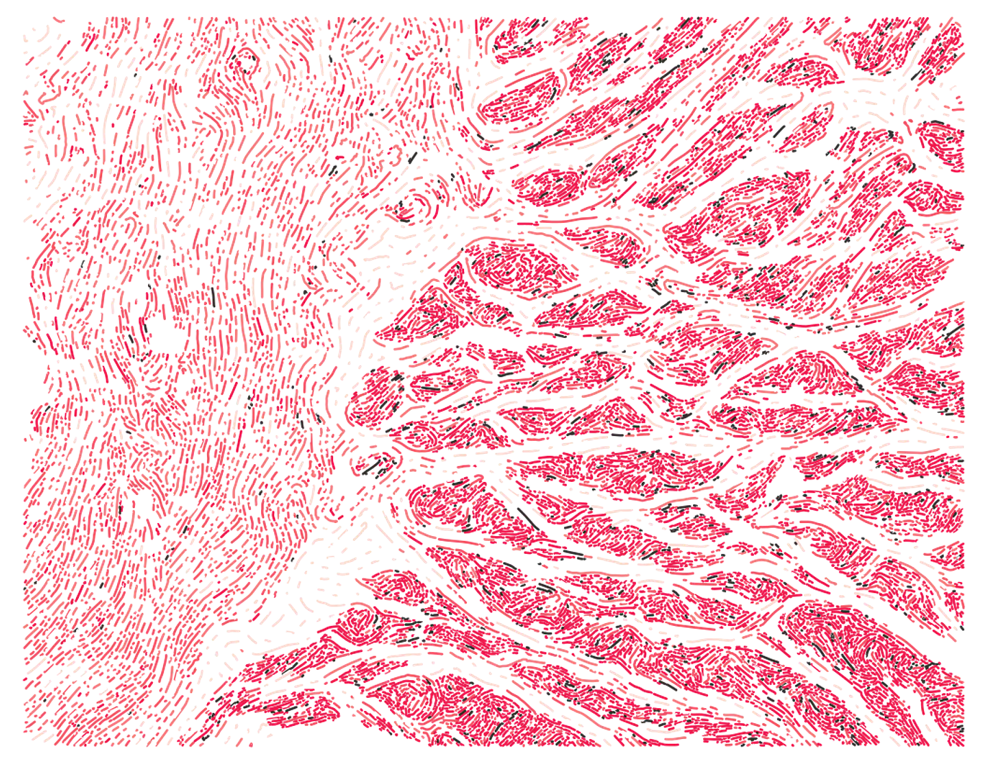 Esophagus Muscularis 1