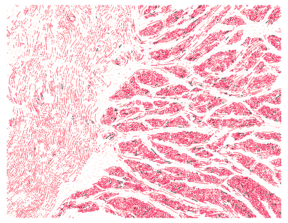 Esophagus Muscularis 1