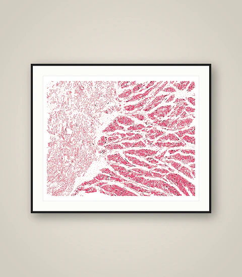 Esophagus Muscularis
