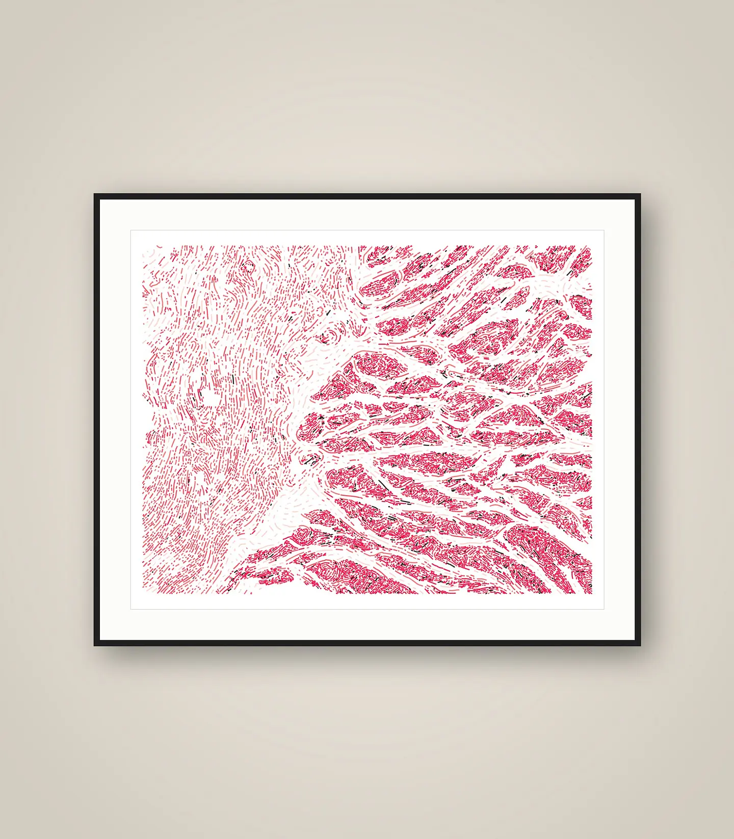 Esophagus Muscularis 1