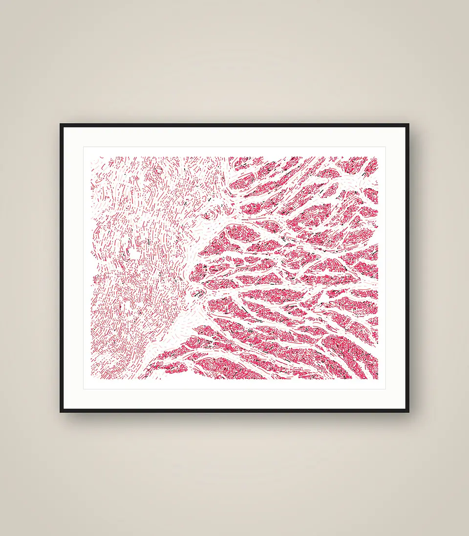 Esophagus Muscularis 1