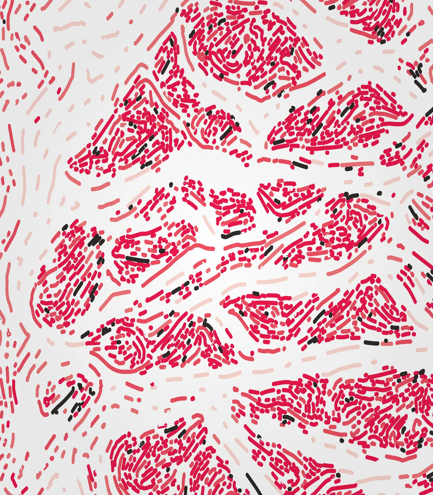 Esophagus Muscularis 2