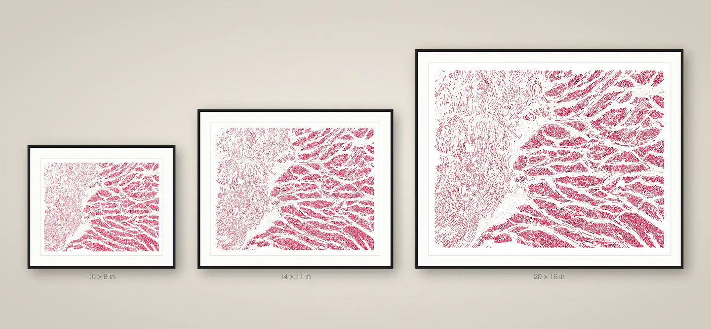 Esophagus Muscularis 3