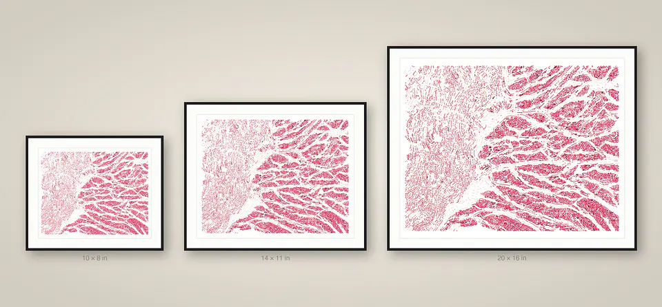 Esophagus Muscularis 3