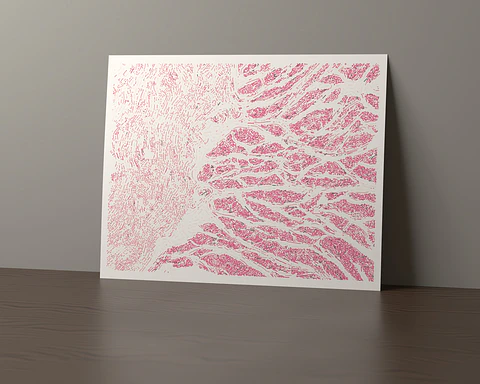 Esophagus Muscularis
