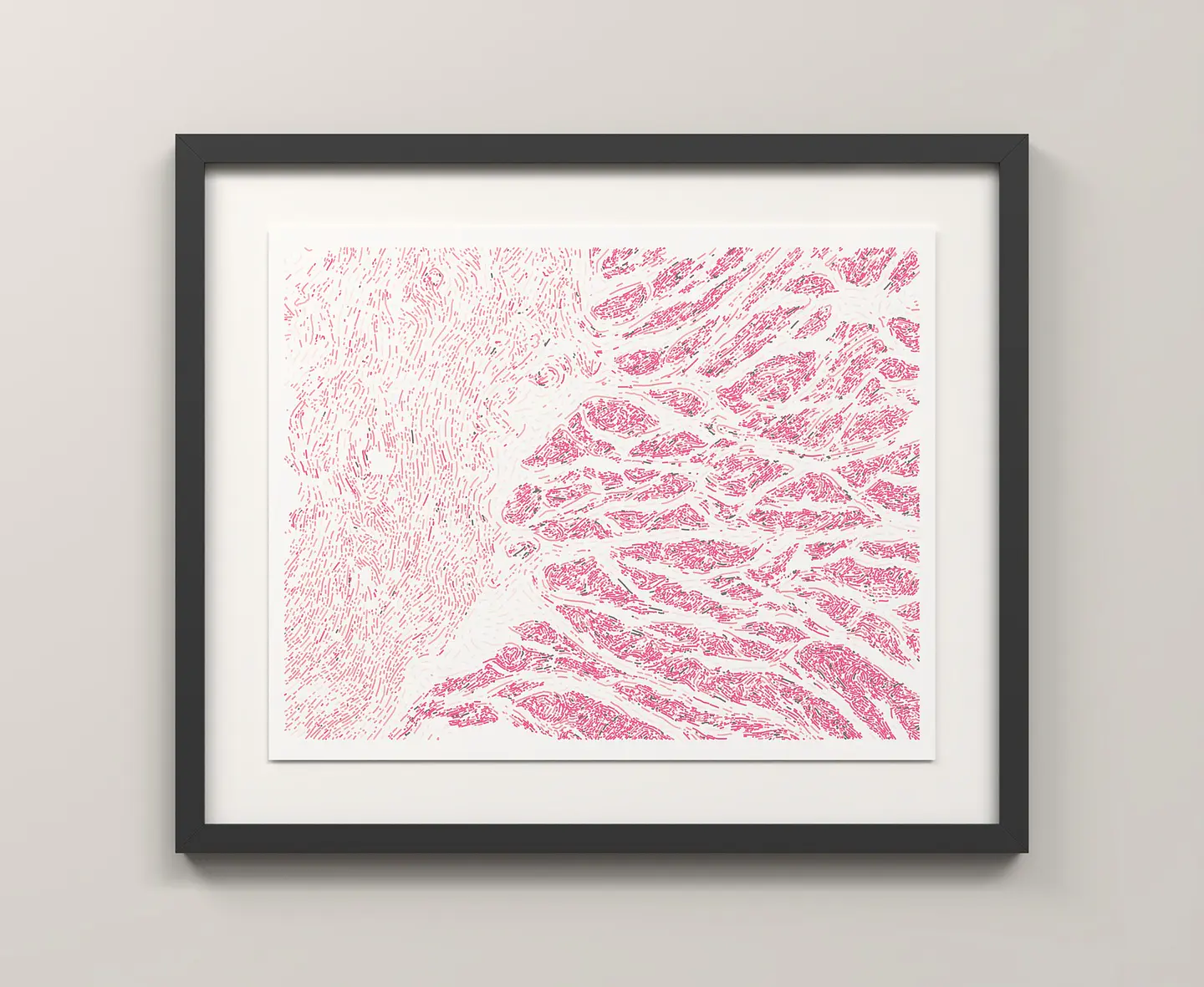 Esophagus Muscularis 3
