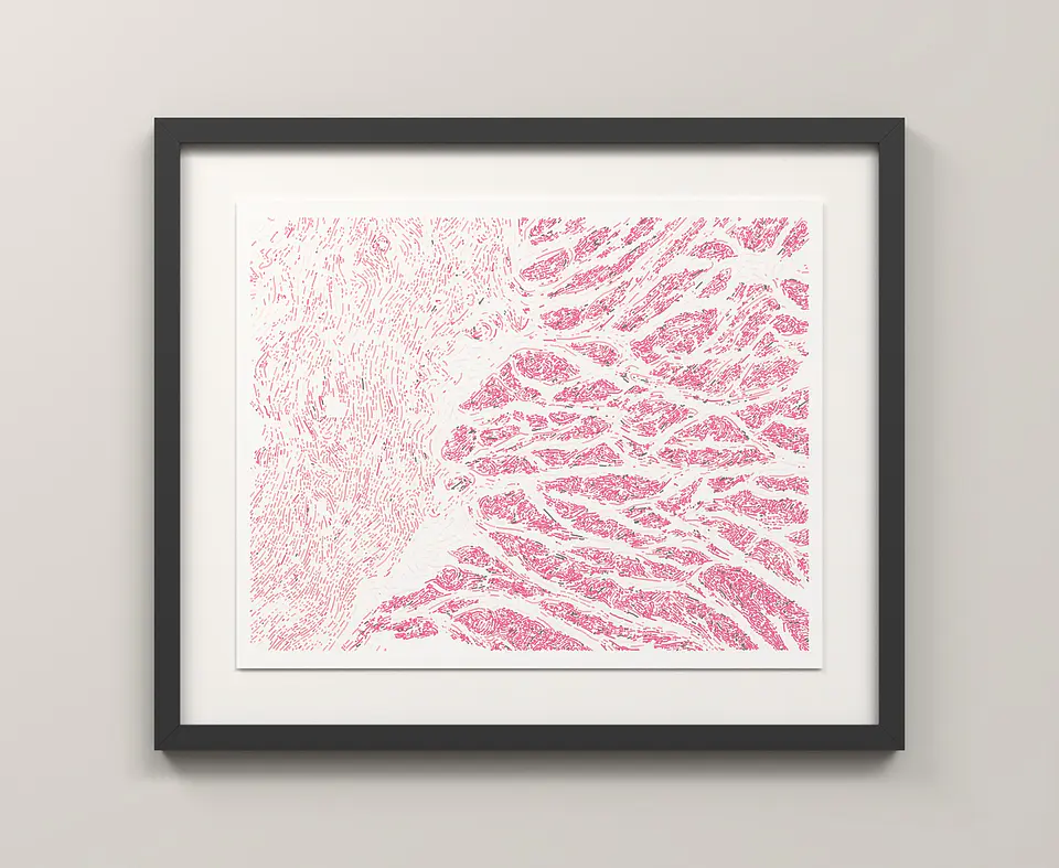 Esophagus Muscularis 3