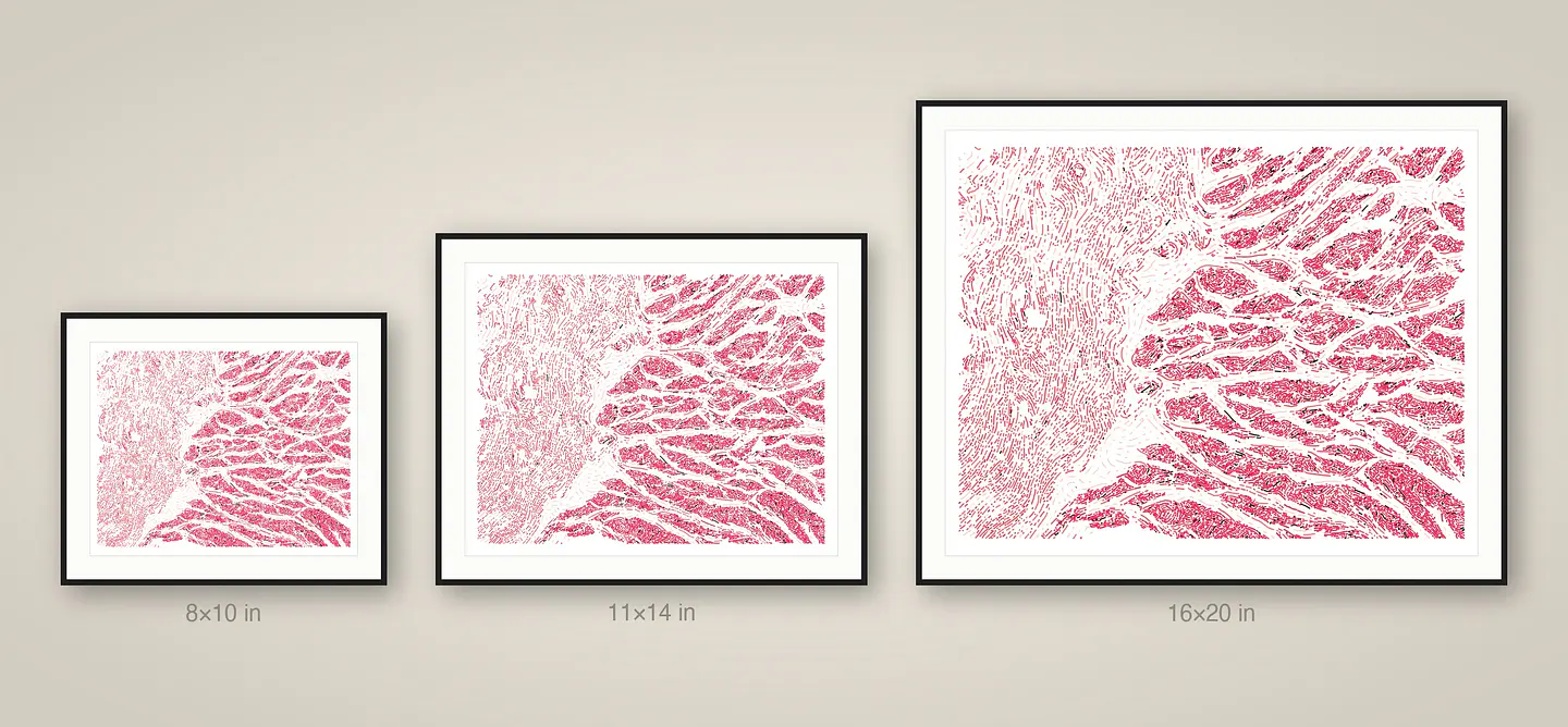 Esophagus Muscularis 5