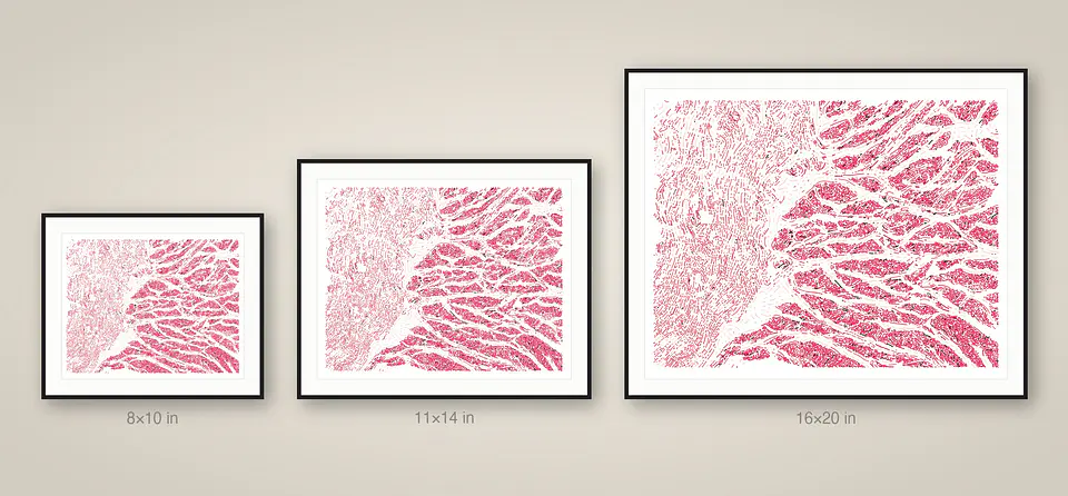 Esophagus Muscularis 5
