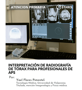Curso ﻿Interpretación de Radiografía de Tórax para profesionales de APS (31hrs)