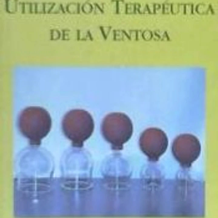 Utilización Terapéutica de la Ventosa 1