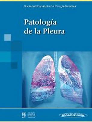 Patología de la Pleura