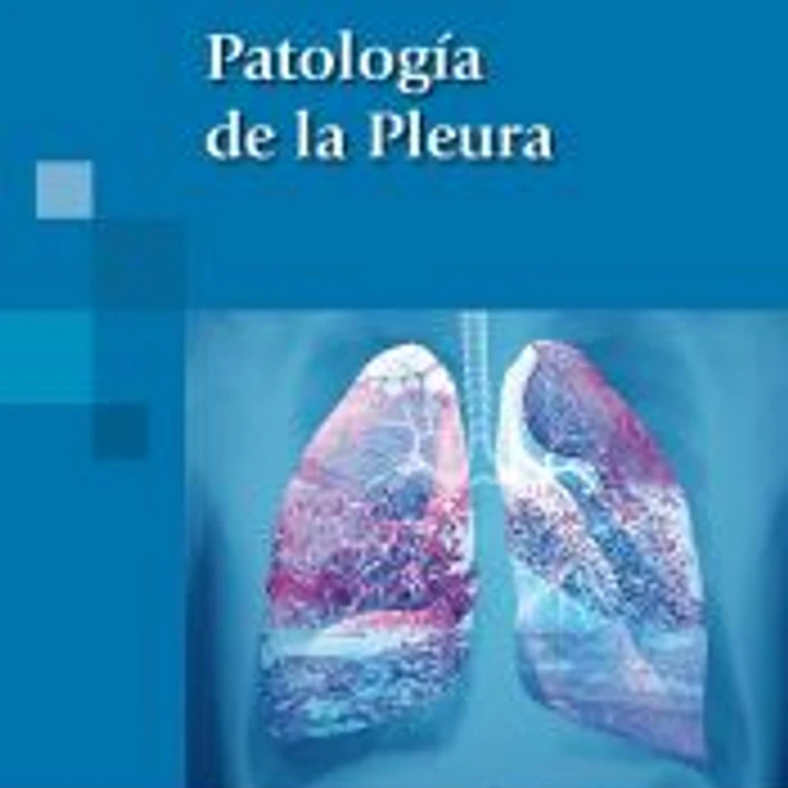 Patología de la Pleura 1