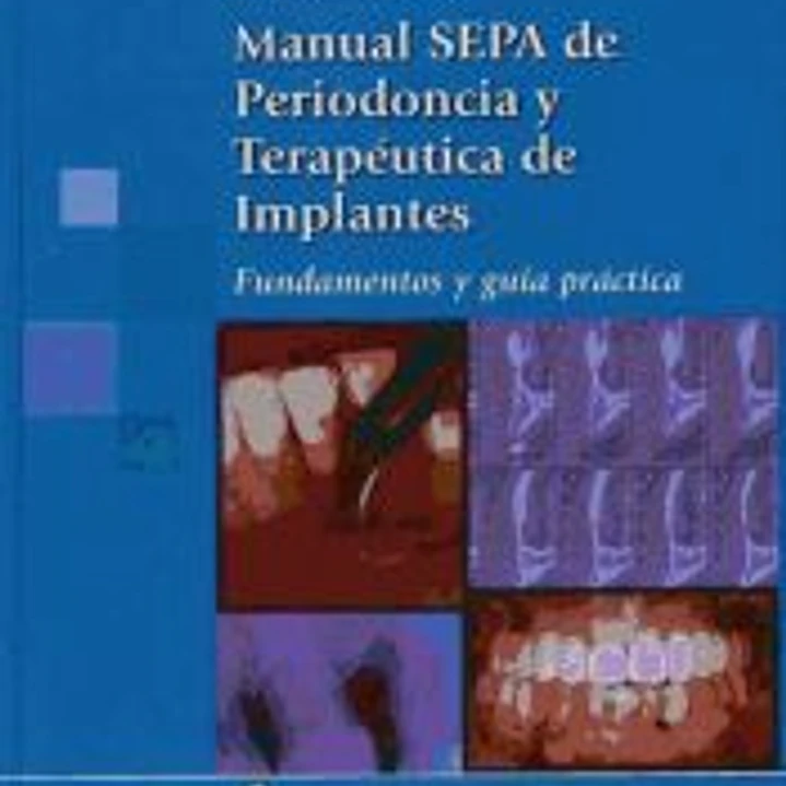 Manual S.E.P.A. de Periodoncia y Terapéutica de Implantes. Fundamentos y guía práctica 1