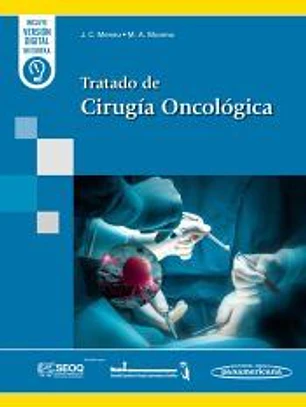 Tratado de Cirugía Oncológica