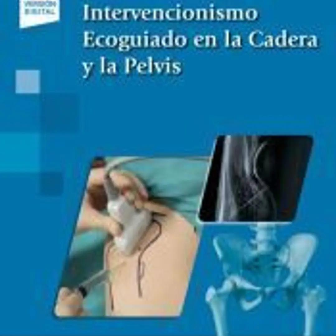 Intervencionismo Ecoguiado en la cadera y la pelvis 1