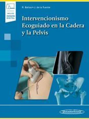 Intervencionismo Ecoguiado en la cadera y la pelvis