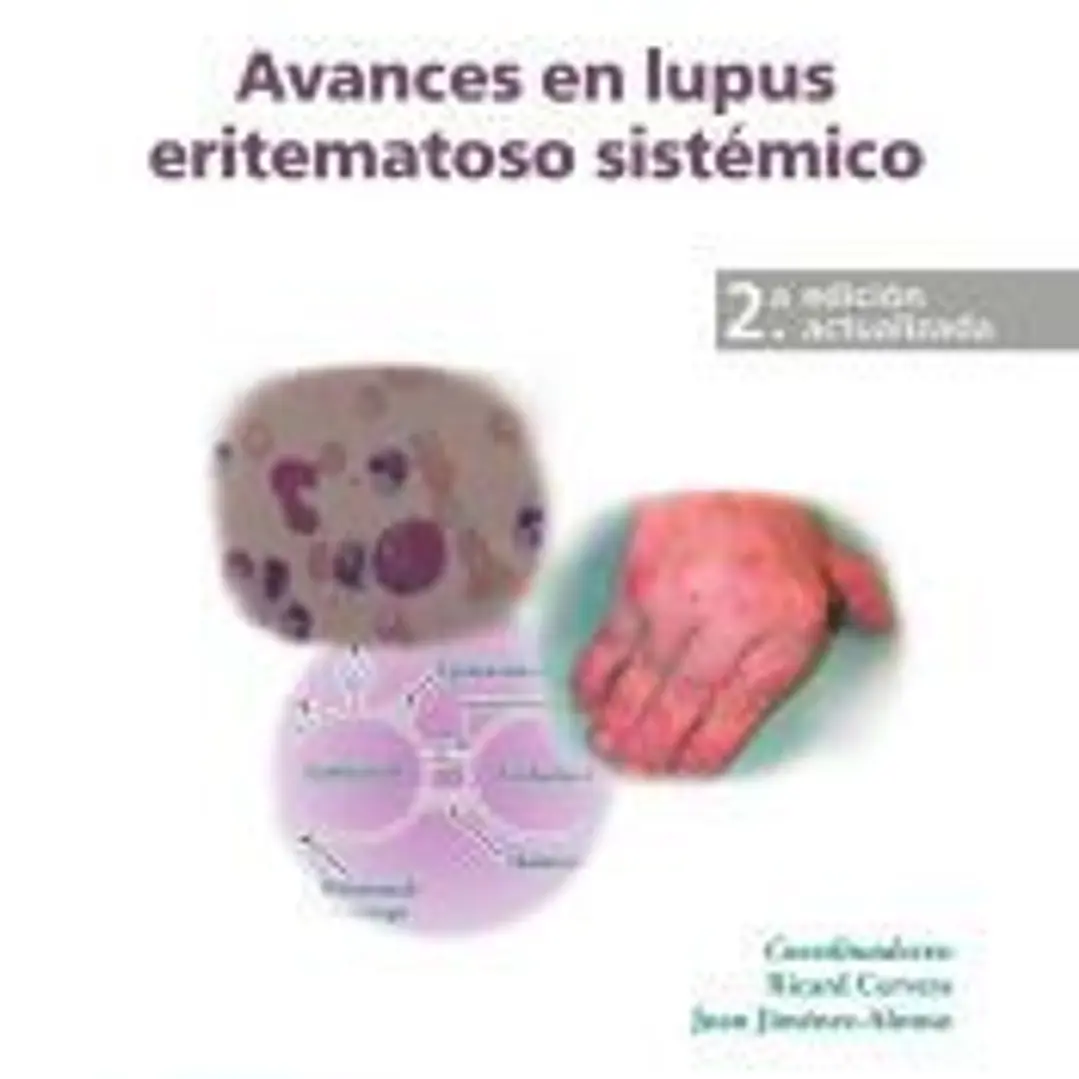 AVANCES EN LUPUS ERITEMATOSO SI 1