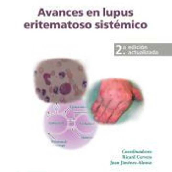 AVANCES EN LUPUS ERITEMATOSO SI 1