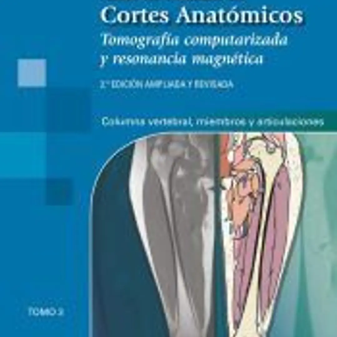 ATLAS DE CORTES ANATÓMICOS.TOMO 3. 2ª ED. 1