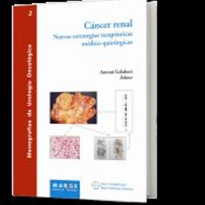 Cáncer renal. Nuevas estrategias terapeuticas medico-quirurgicas 1