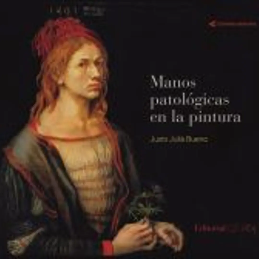 Manos patológicas en la pintura 1