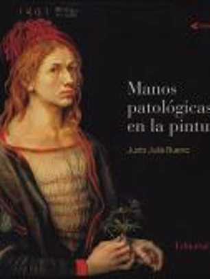 Manos patológicas en la pintura