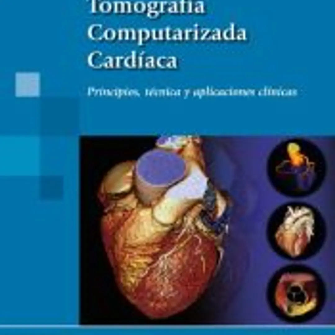 Tomografía Computarizada Cardíaca 1