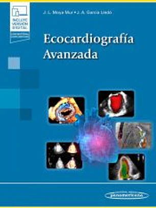Ecocardiografía Avanzada + e-book