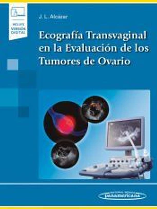 Ecografía Transvaginal en la Evaluación de los Tumores de Ovario (incluye versión digital)