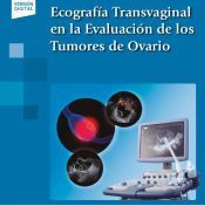 Ecografía Transvaginal en la Evaluación de los Tumores de Ovario (incluye versión digital) 1