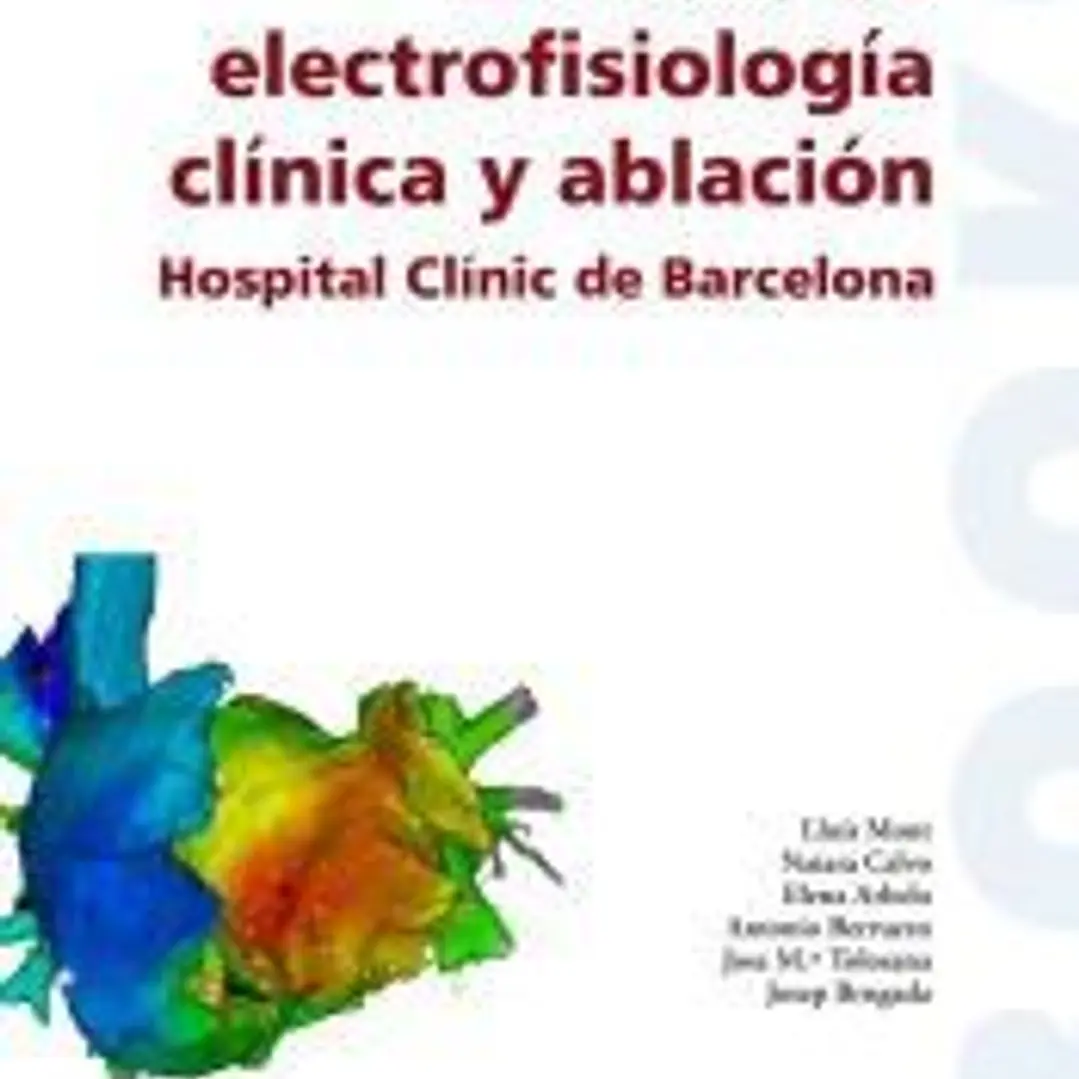 Manual de electrofisiología clínica y ablación 1