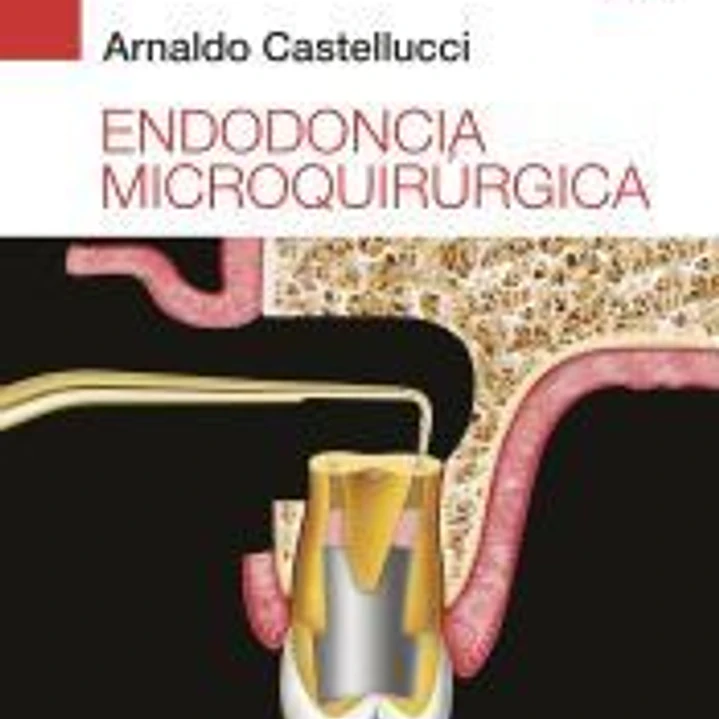 Endodoncia microquirúrgica 1