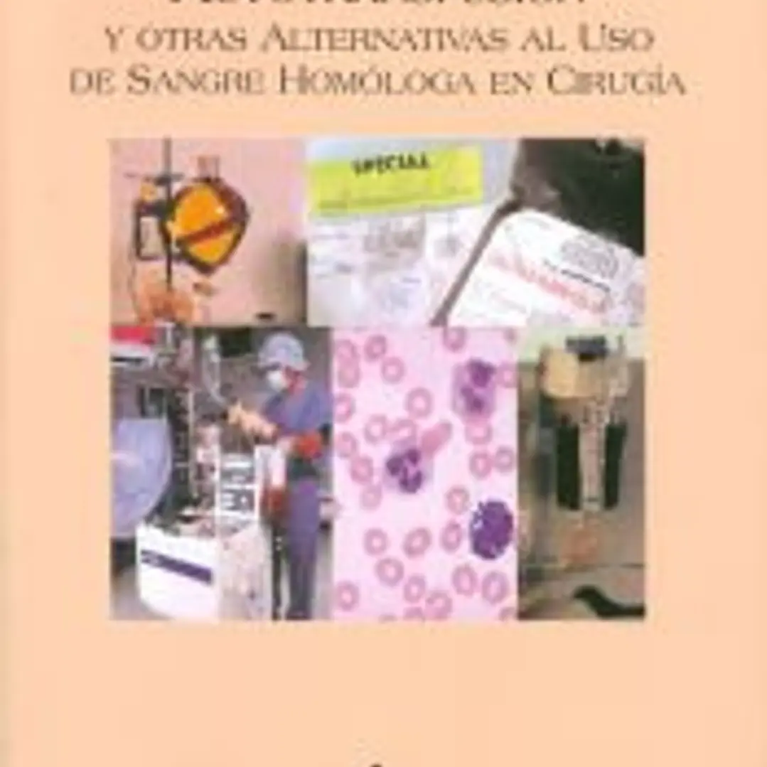 Autotransfusión y otras alternativas al uso de sangre homóloga en cirugía 1
