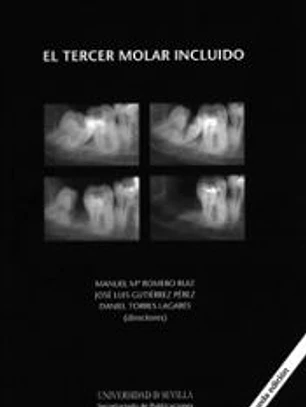 EL TERCER MOLAR INCLUIDO. 2ED