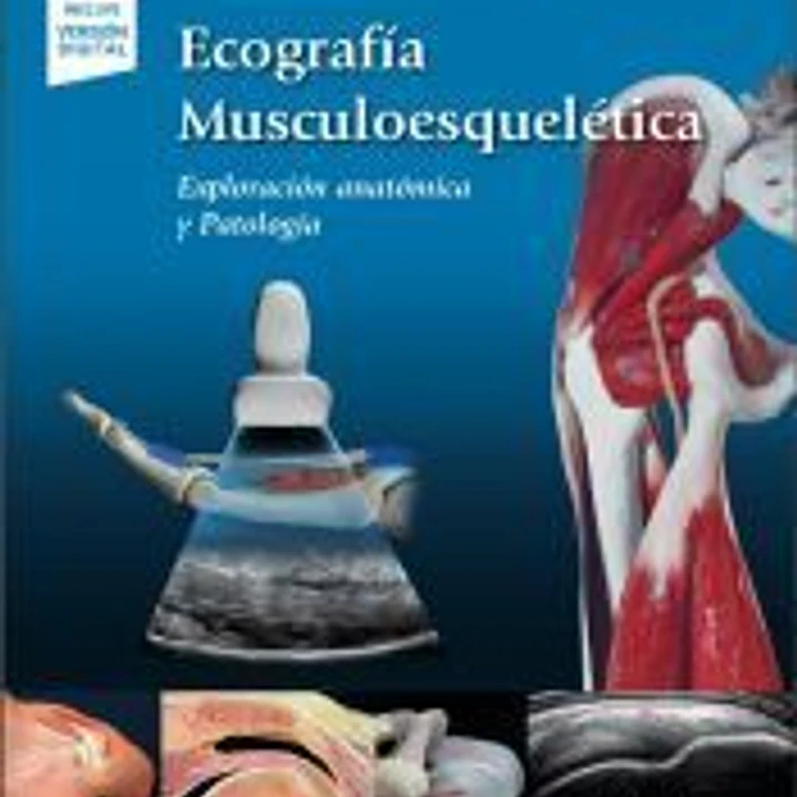 Ecografía Musculoesquelética: Exploración anatómica y Patología 1
