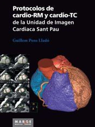 Protocolos de cardio-RM y cardio-TC de la Unidad de Imagen Cardiaca Sant Pau