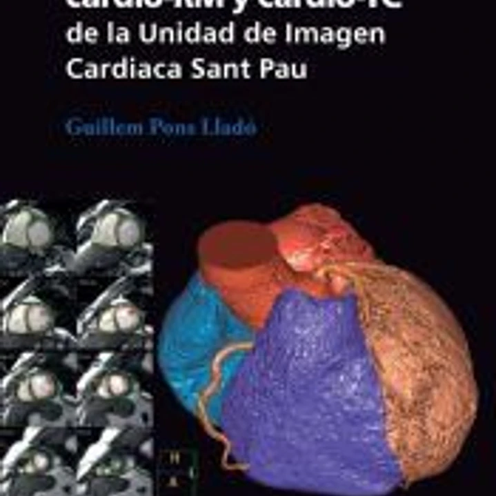 Protocolos de cardio-RM y cardio-TC de la Unidad de Imagen Cardiaca Sant Pau 1
