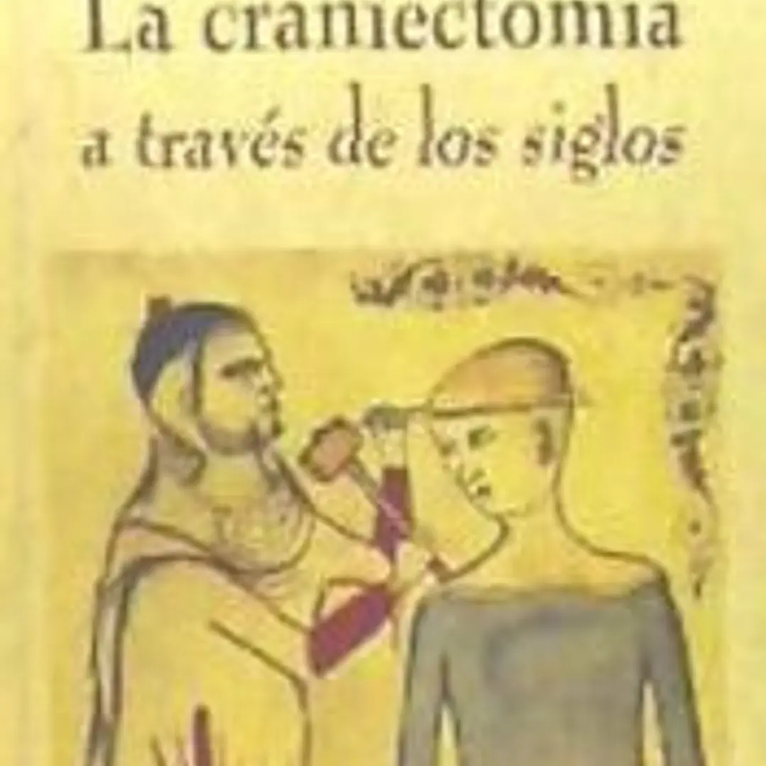 La craniectomía a través de los siglos 1
