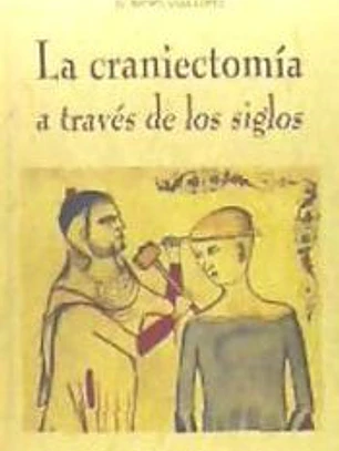 La craniectomía a través de los siglos